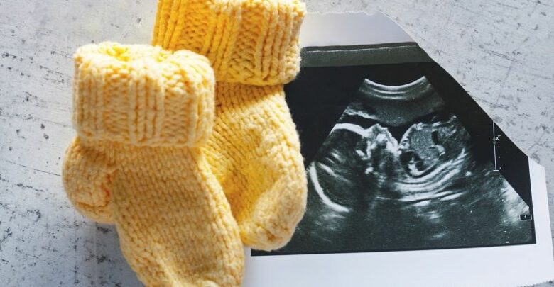 Knitted-socks-for-the-child,-lying-on-the-picture-ultrasound.-cm